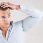 Hair Growth Products for Men Facing Baldness Head-On